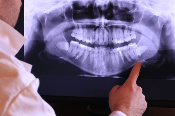Best Emergency Treatment for Jaw Pain or Injury in Carlisle, KY